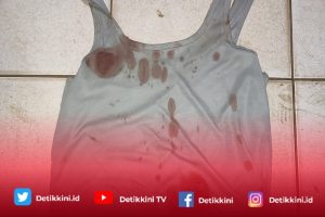 Terlibat Kasus Penganiayaan, Seorang Warga Lamsel Ditangkap Polres Lamtim